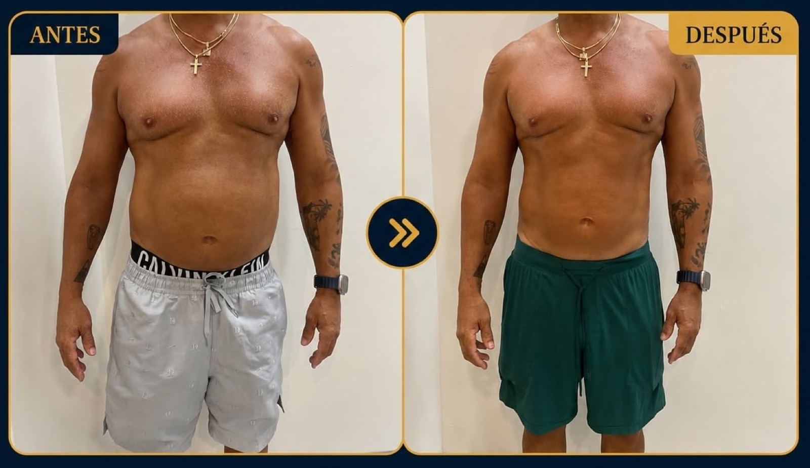 Resultado real de antes y después de una clienta de The Body Lab